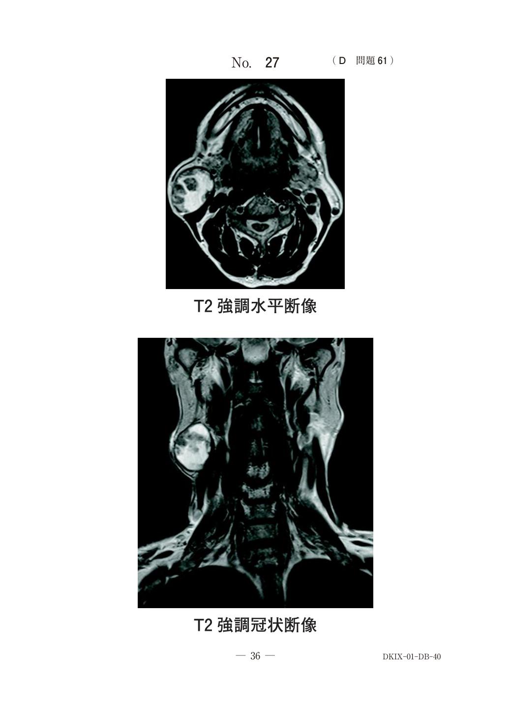 問題の画像
