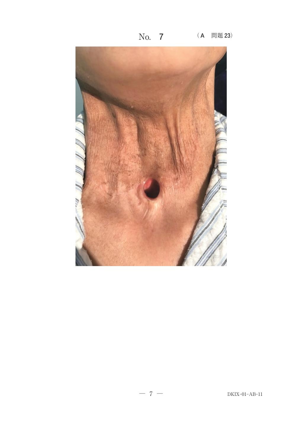 問題の画像
